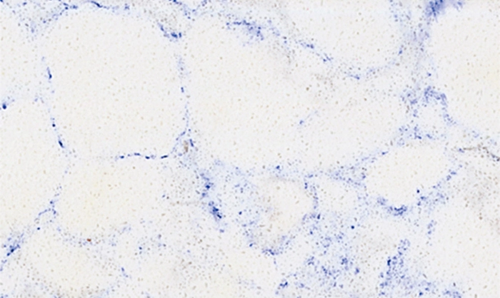 ALD-Vein-QZ077 1