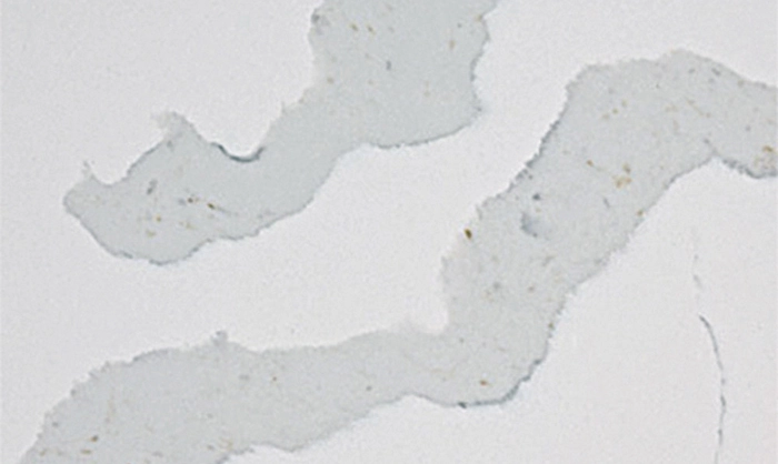 ALD-Vein-QZ062 1