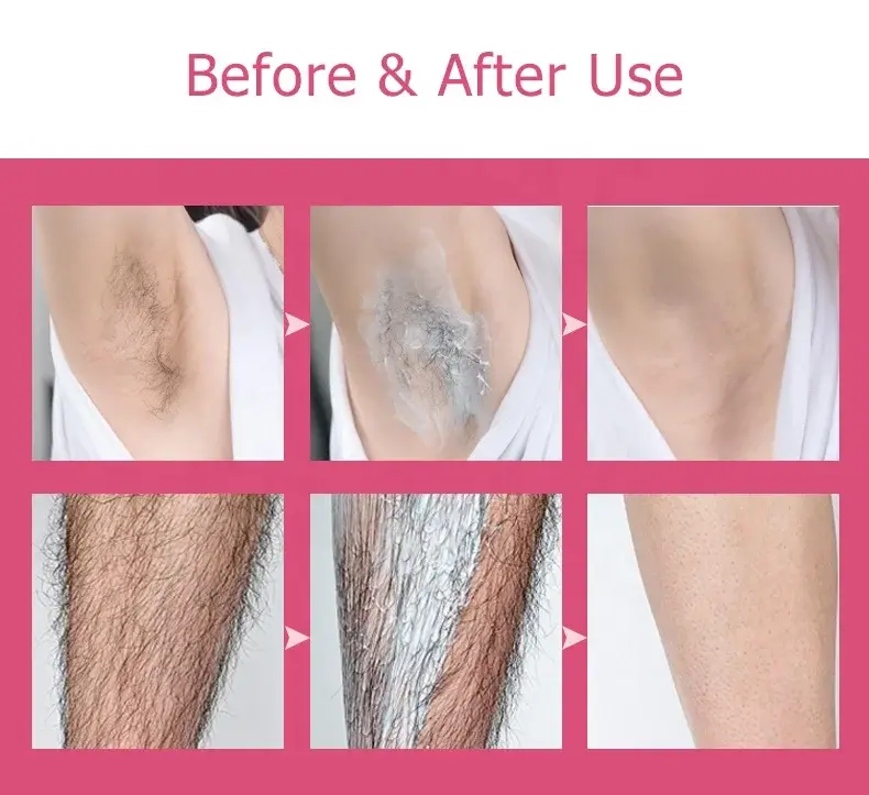 Wholesale Skincare Suppliers OEM:20~45 Days Bikini/Intimatewholesale 4