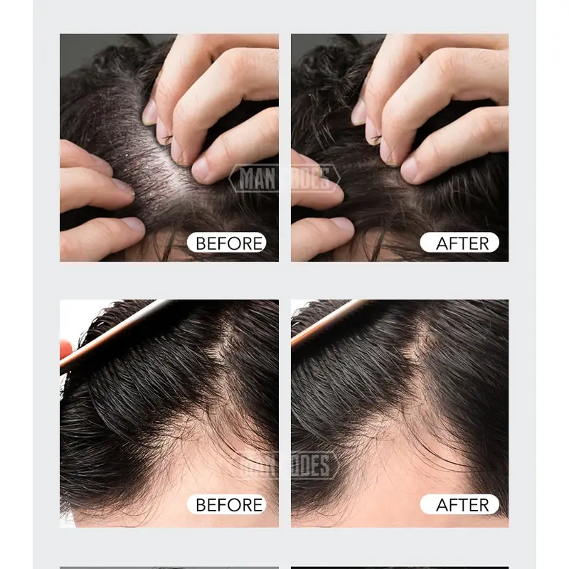 Sulfate Free Hair Shampoo by HuiJi 3