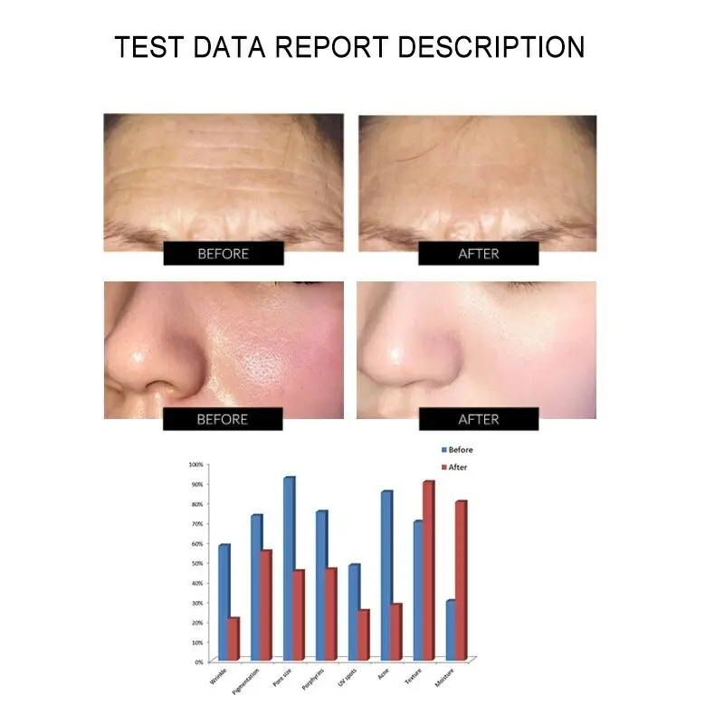New Model Red Light Facial Therapy Price List 5