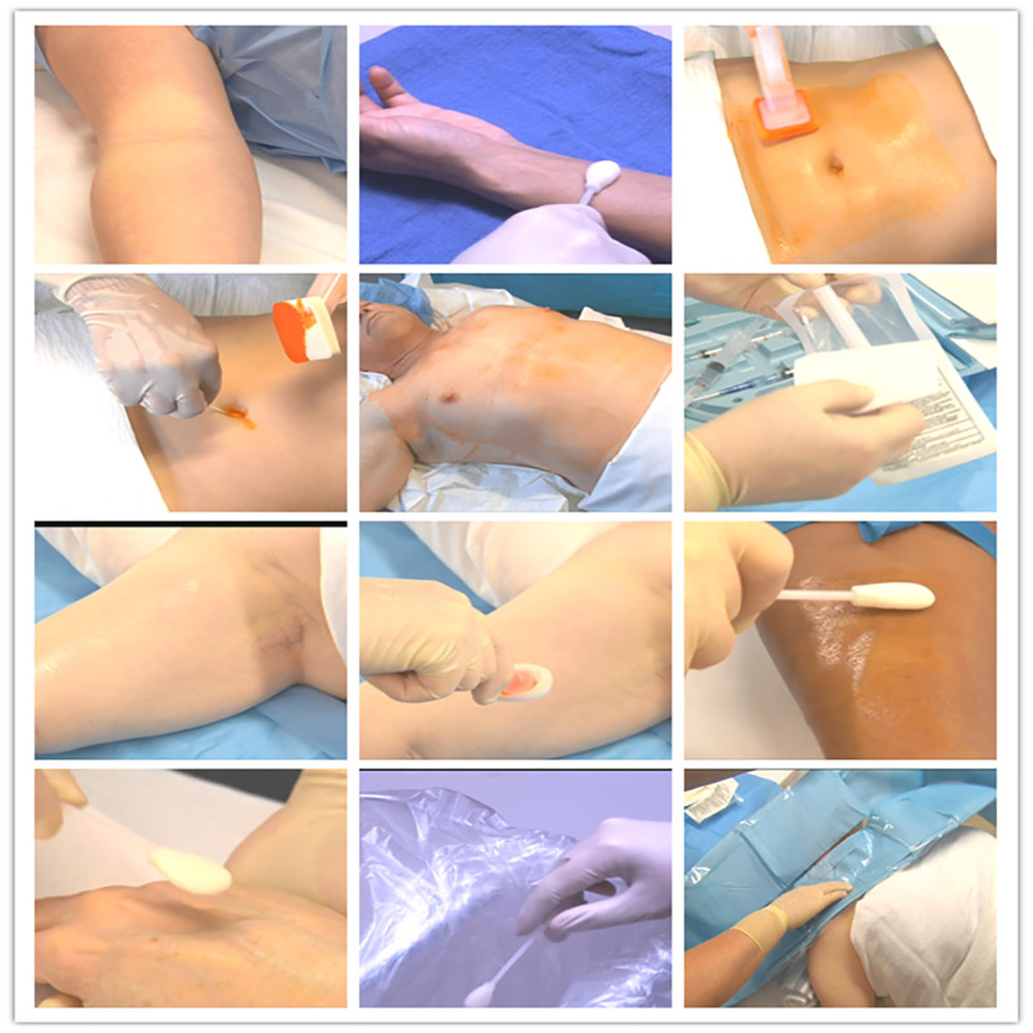 Cleanmo medical grade 100PPI open-cell polyurethane foam 2%CHG/70% IPA applicators wholesale for surgical site cleansing after suturing 8