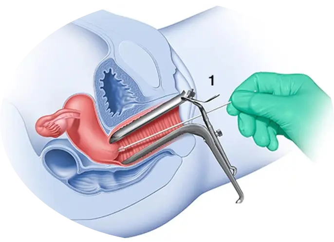high recovery dna swab test frosted tail of swab handle factory for rapid antigen testing 4