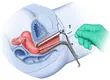 high recovery dna swab test frosted tail of swab handle factory for rapid antigen testing 4