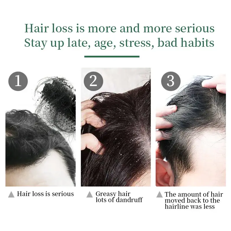 Good Sellingmoroccanoil Hair Mask for Hair 30mL Vegan 6