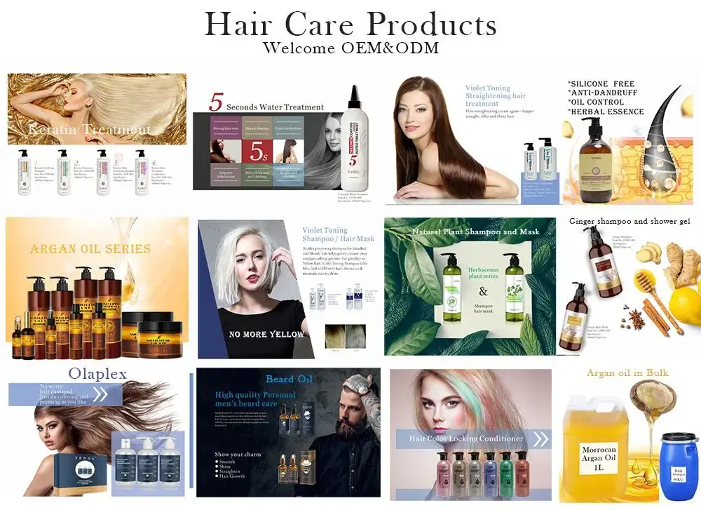 Hot Selling Scalp Treatment Scalp Treatment Company 3