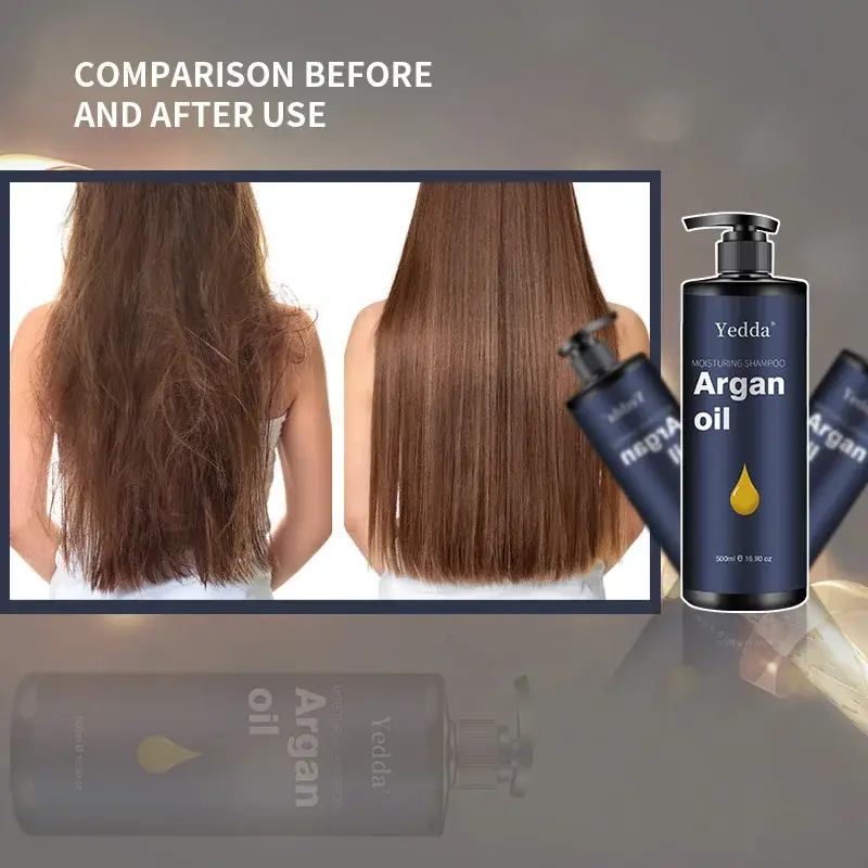 Hot Selling Scalp Treatment Scalp Treatment Company 6