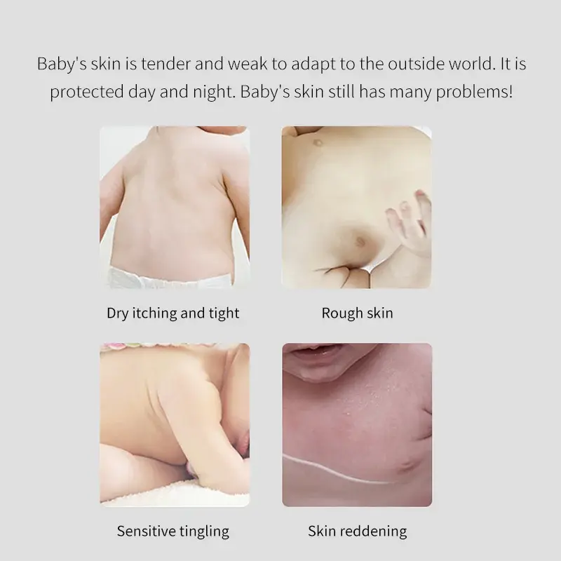 Bulk Production Scalp Exfoliation with Custom Services for Kids Skin Care 3
