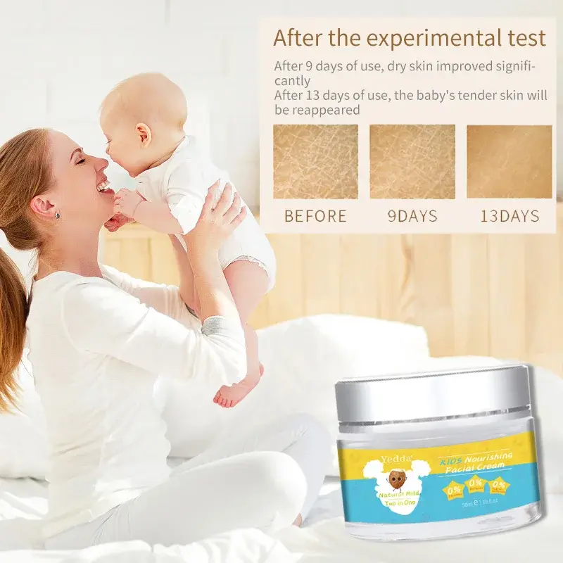 Bulk Production Scalp Exfoliation with Custom Services for Kids Skin Care 6