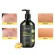 Hot Sale Hair Growth Products for Men Hair Growth Products for Men Company 3