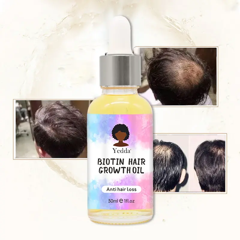 Men's Hair Loss Shampoo for Hair LYHL-003factory Direct Supply 5