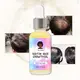 Men's Hair Loss Shampoo for Hair LYHL-003factory Direct Supply 5