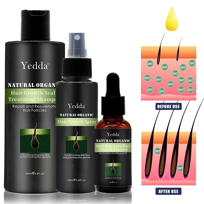 Newly Hair Serum Supply for Hair Care 3