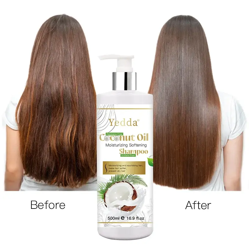 Yedda Hair Loss Shampoo for Women Coconut Oil Shampoo Set Hair Loss Shampoo for Womenfactory 5