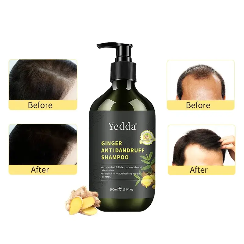 Ginger-infused Shampoo: The Secret To Luscious Locks 1