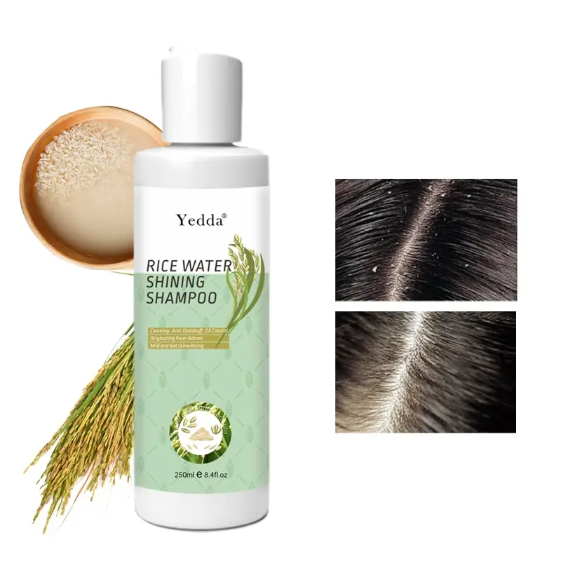 Protein Treatment for Curly Hair 3.years Lighteningmade in China 6