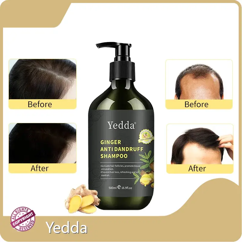 Keratin Hair Treatment Gel Anti Hair Loss Shampoofactory Direct Supply 1