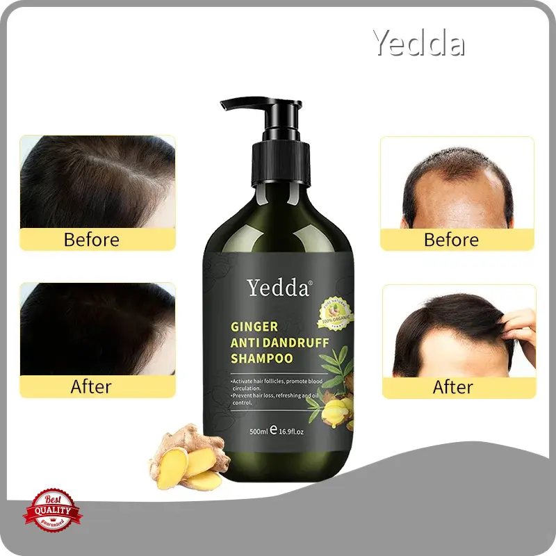 Customized Shampoo for Hair 3yearsfactory Price 1