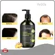 Customized Shampoo for Hair 3yearsfactory Price 1