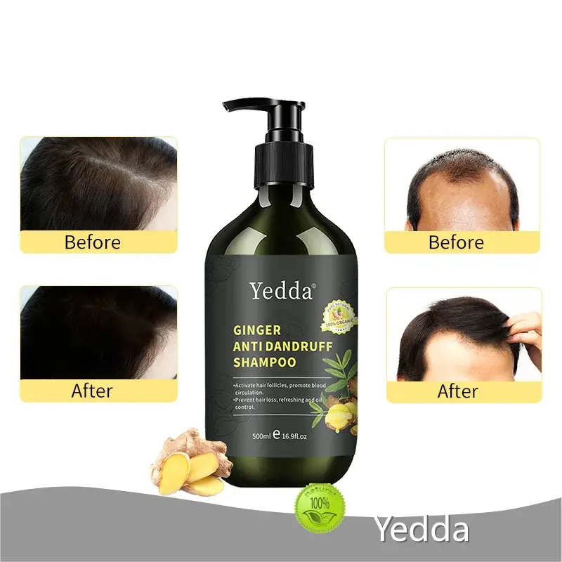 For Hair Care Anti Hair Fall Shampoo 2-IN-1 by Yedda 1