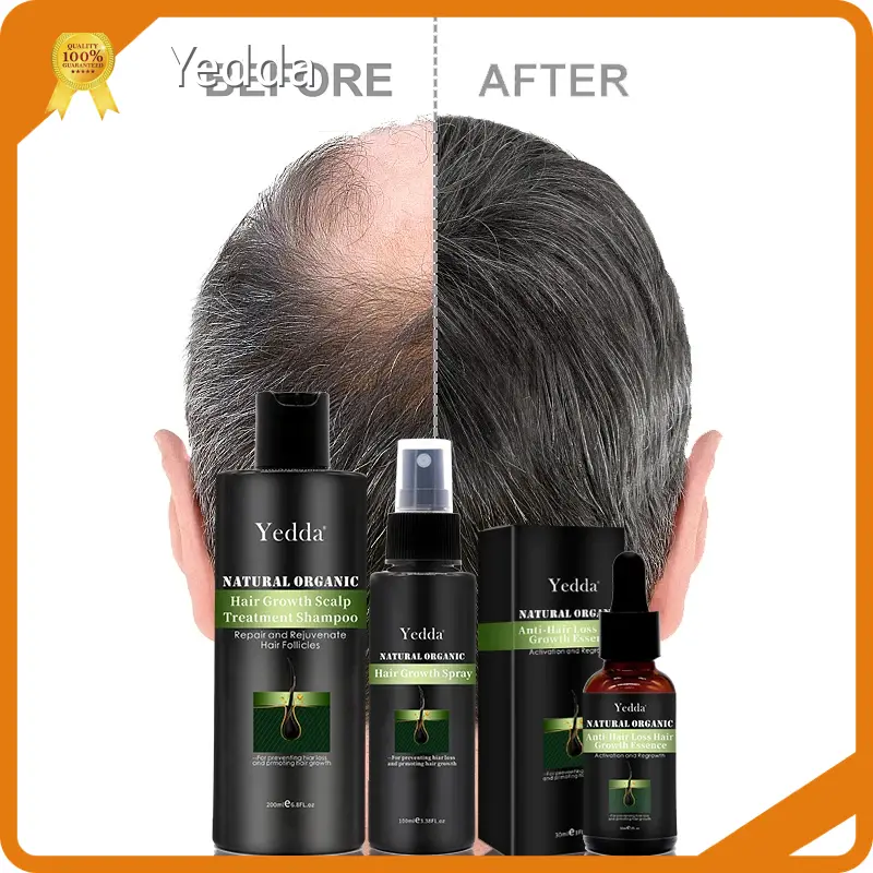Bulk Shampoo for Oily Hair Manufacturing for Hair 1
