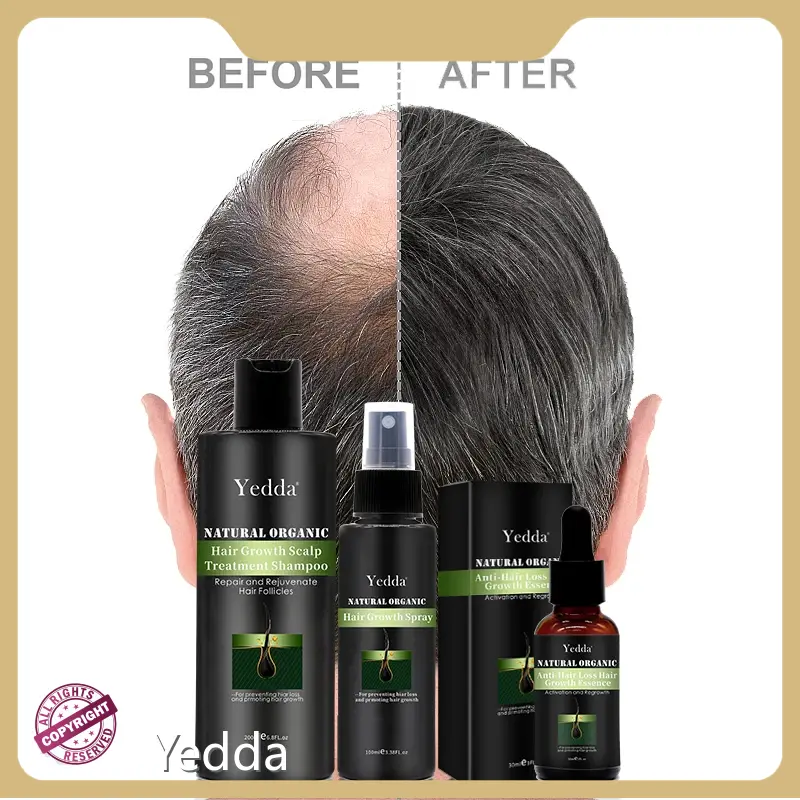 Wholesale Hair Growth Oil Manufacturer From China for Hair 1