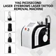 Long Lasting Facial Machine for Personal Use 6