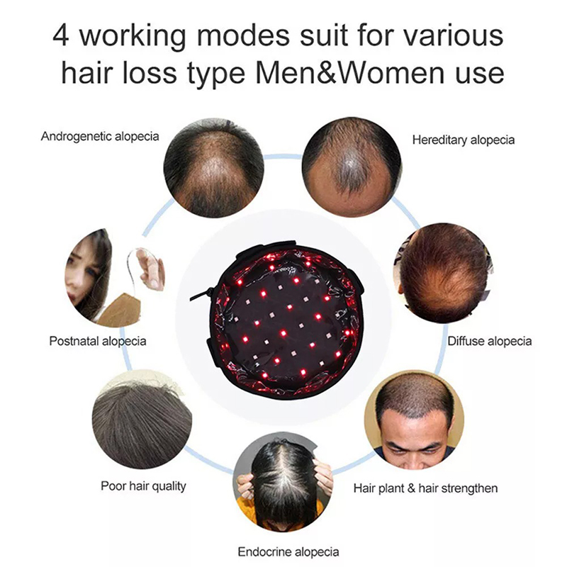 Customized Red Light Hat for Hair Growth Price List 6