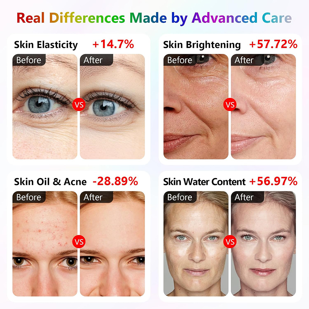 iLUXRED Red Light Therapy Mask Company LED Red Light Mask MASK-04 5