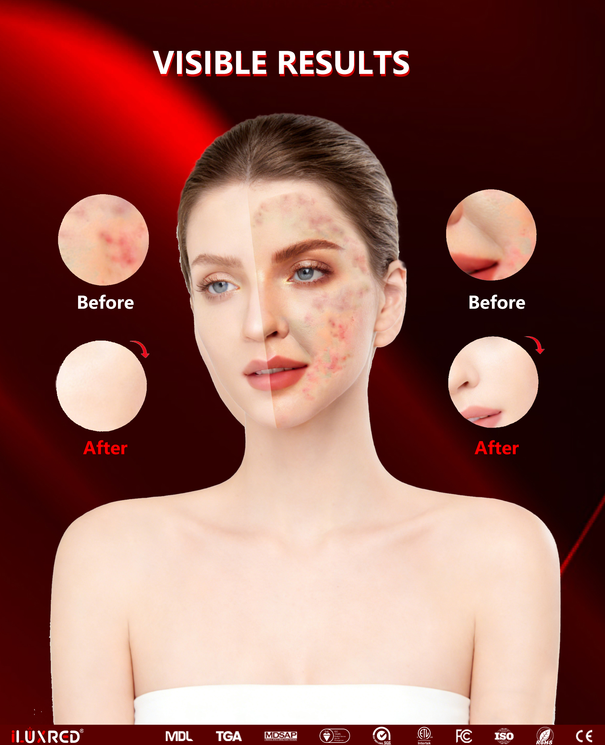 ILUXRED 510K FDA Professional Silicone Red Light Therapy Face Neck Mask Red Light Therapy Mask Led Facial Mask with battery 10