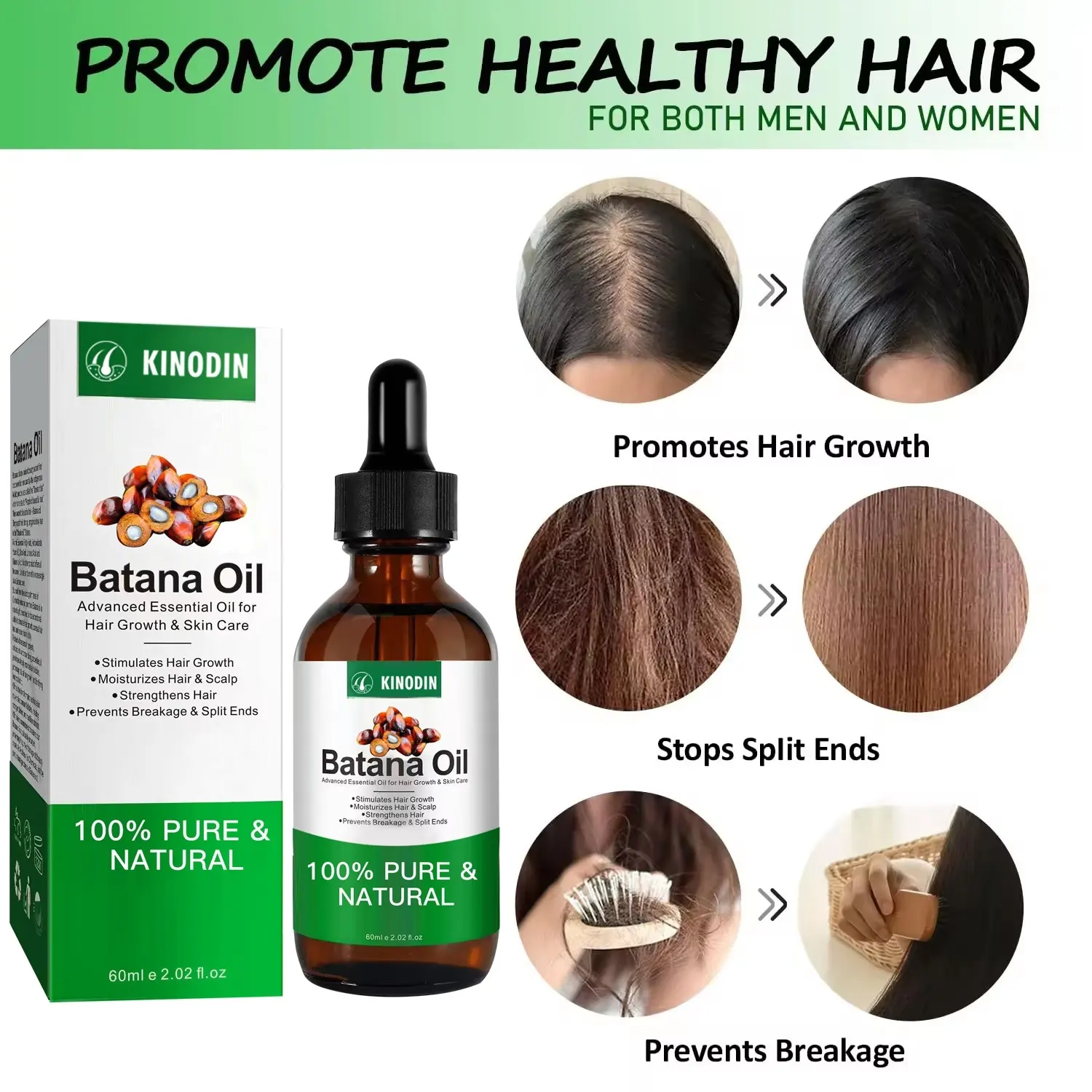 Kinodin Hair Growth Products for Women FB33703 Hair Growth Products for Womenwith Good Price 7