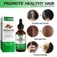 Kinodin Hair Growth Products for Women FB33703 Hair Growth Products for Womenwith Good Price 7