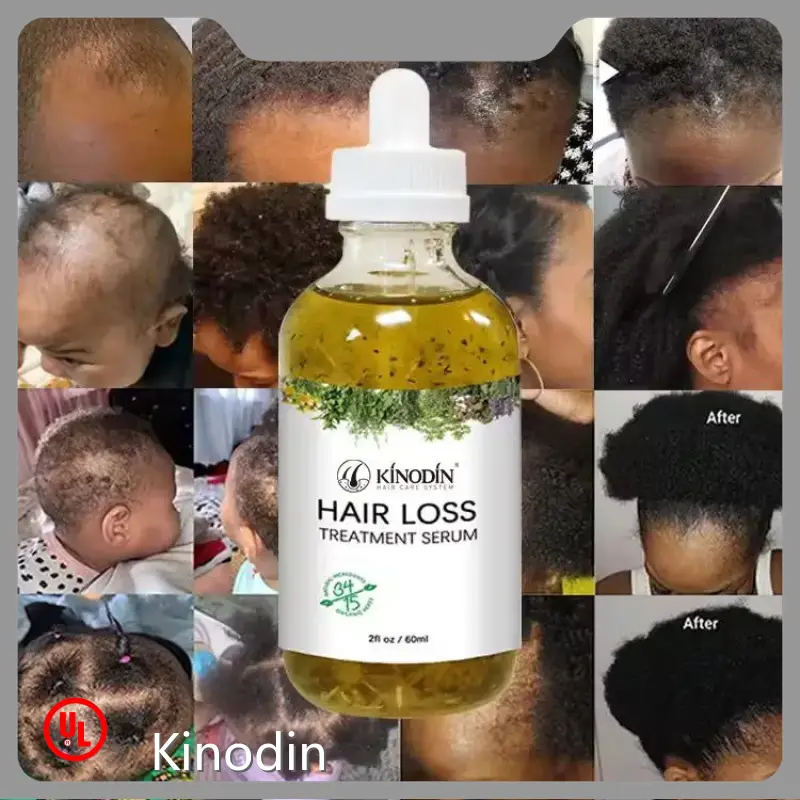 Durable Hair Loss Treatment Price List 1