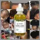 Durable Hair Loss Treatment Price List 1