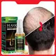 Hot Sale Tea Tree Scalp Treatment 1