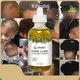 Hair Growth Vitamins for Women OEM/ODM T/Twith Good Price 1