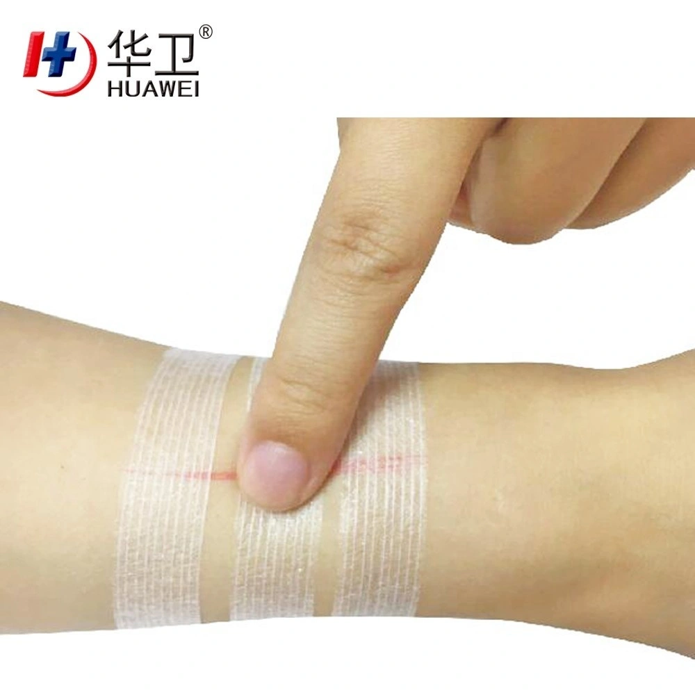 Huawei Factory FDA Medical Grade Sterile Waterproof PU Dressing with iodophor Adhesive Antimicrobial Incise Drape for Surgery136 8