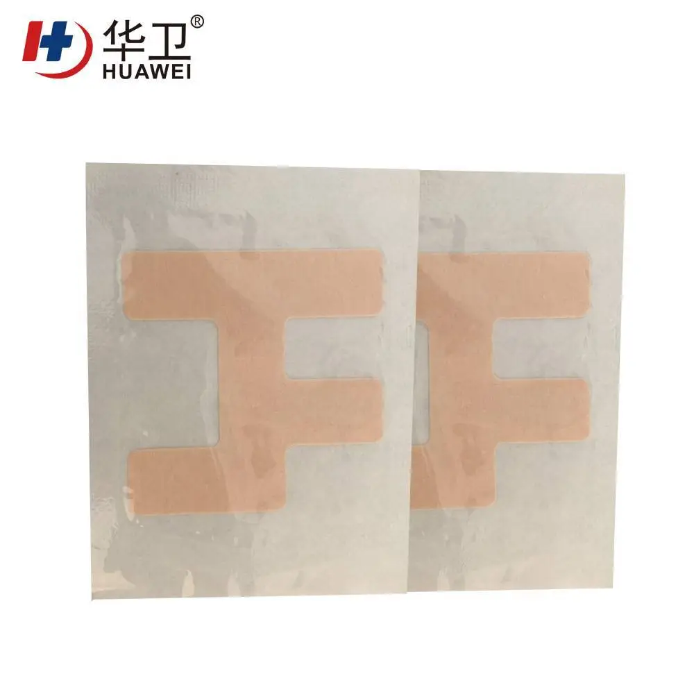 Nasal catheter fixation patch 1