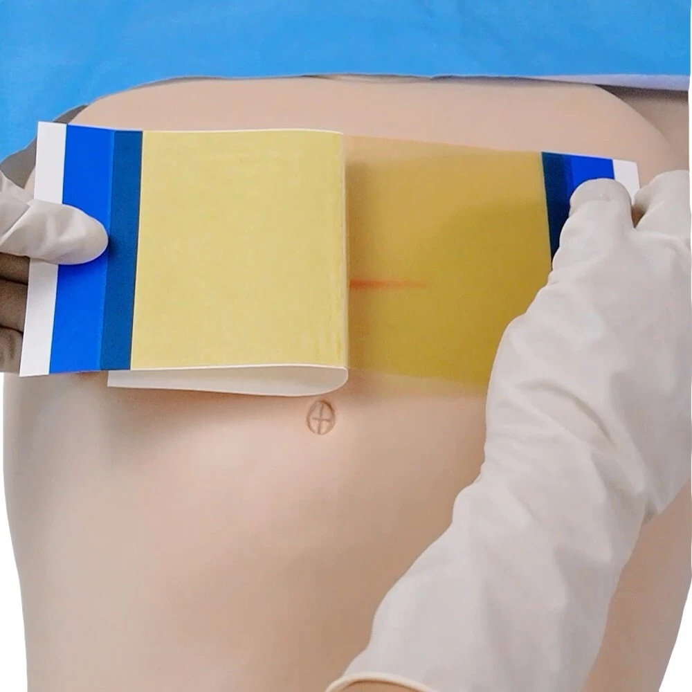 Sterile PU Iodine Incise Dressing for surgery with handle 10