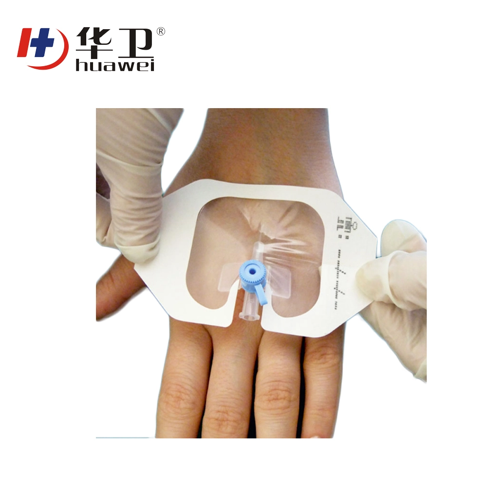 Oem IV Waterproof Self-adhesive PU Film for Cannula fixing Dressing I.V. Transparent Adhesive Advance Securement Dressing For Sale-Huawei 1