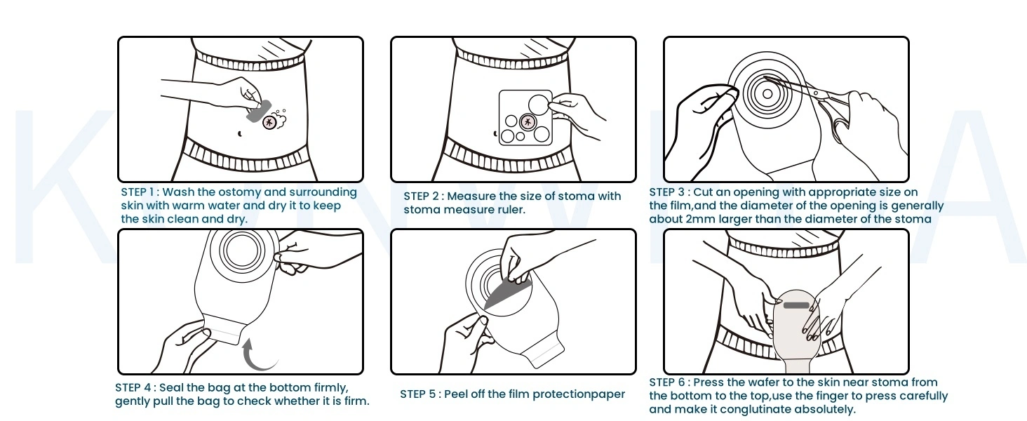 One - Piece Ostomy Pouch - Superior Quality for Your Comfort 12