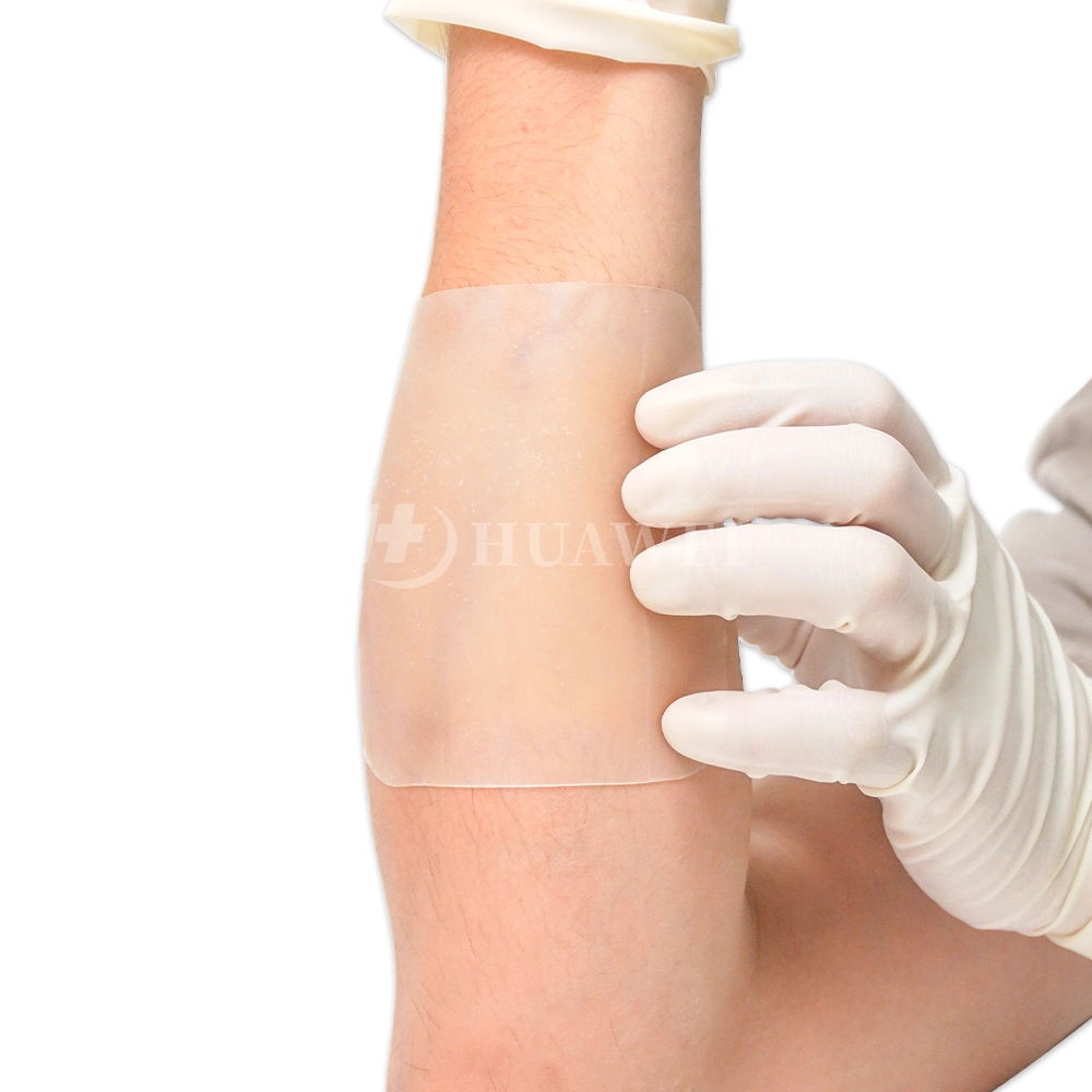 CE FDA Certified Burn Wound Care Hydrocolloid Wound Dressing 1