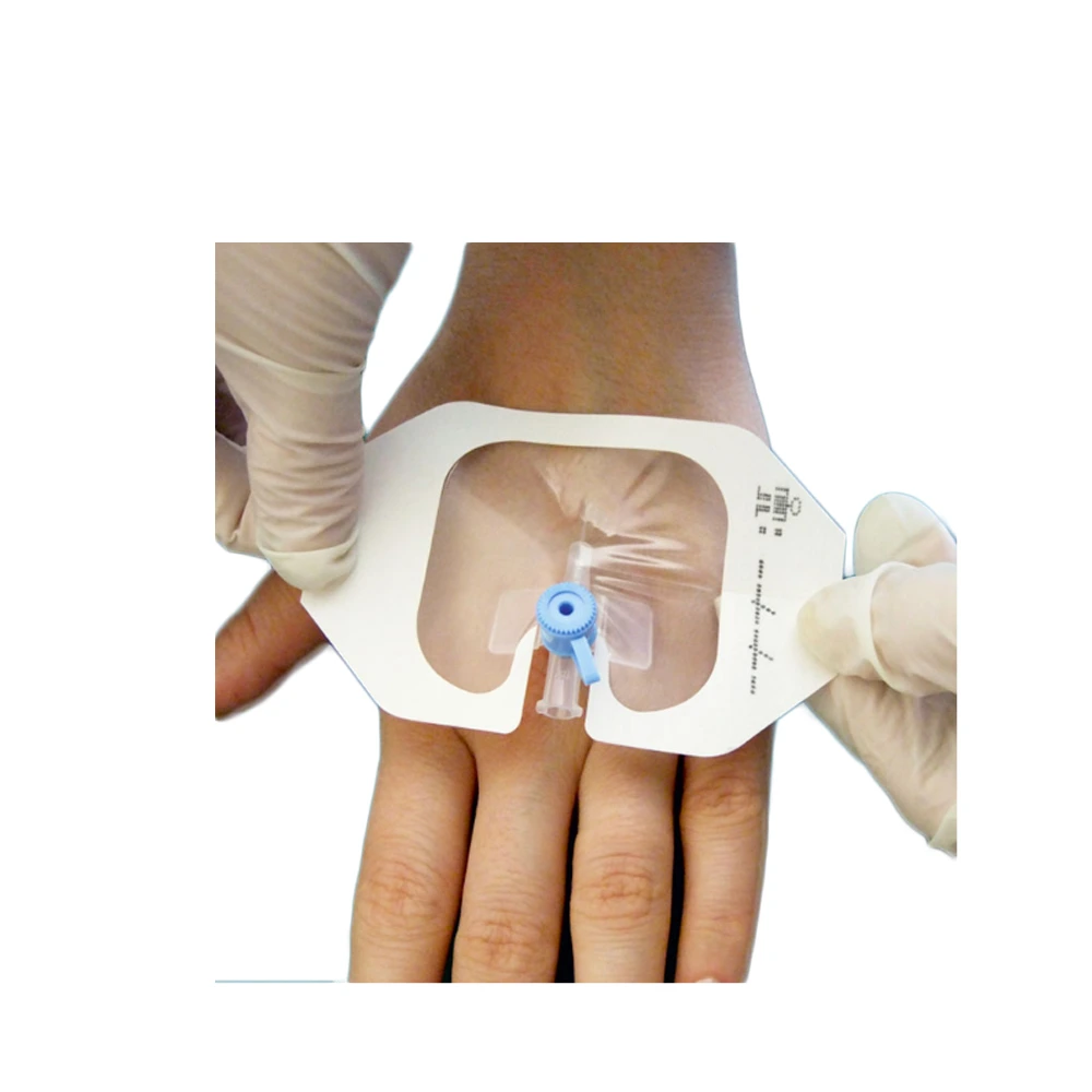 Oem IV Waterproof Self-adhesive PU Film for Cannula fixing Dressing 1