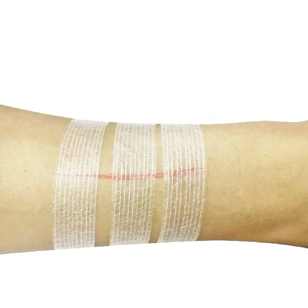 Wound Skin Closure Strip Surgical Tape Wound Closure 1