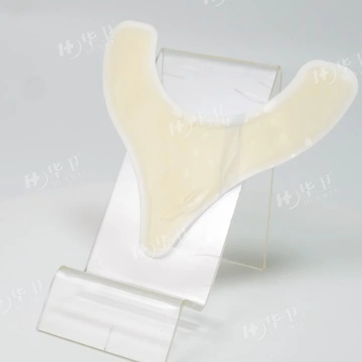 Hydrocolloid Skin Barrier Strips for Ostomy Bags 1