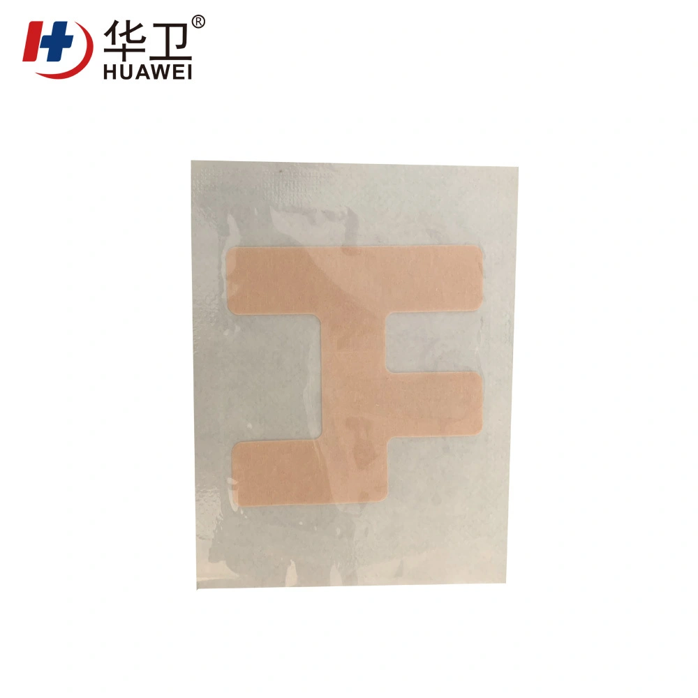 Nasal catheter fixation patch 7
