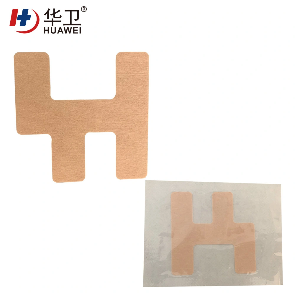 Nasal catheter fixation patch 10
