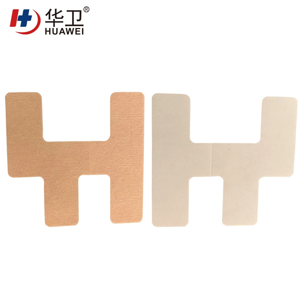 Nasal catheter fixation patch 9
