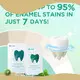 White Teeth Whitening Strips Home/Salon/Clinic/Office by Bi White 1