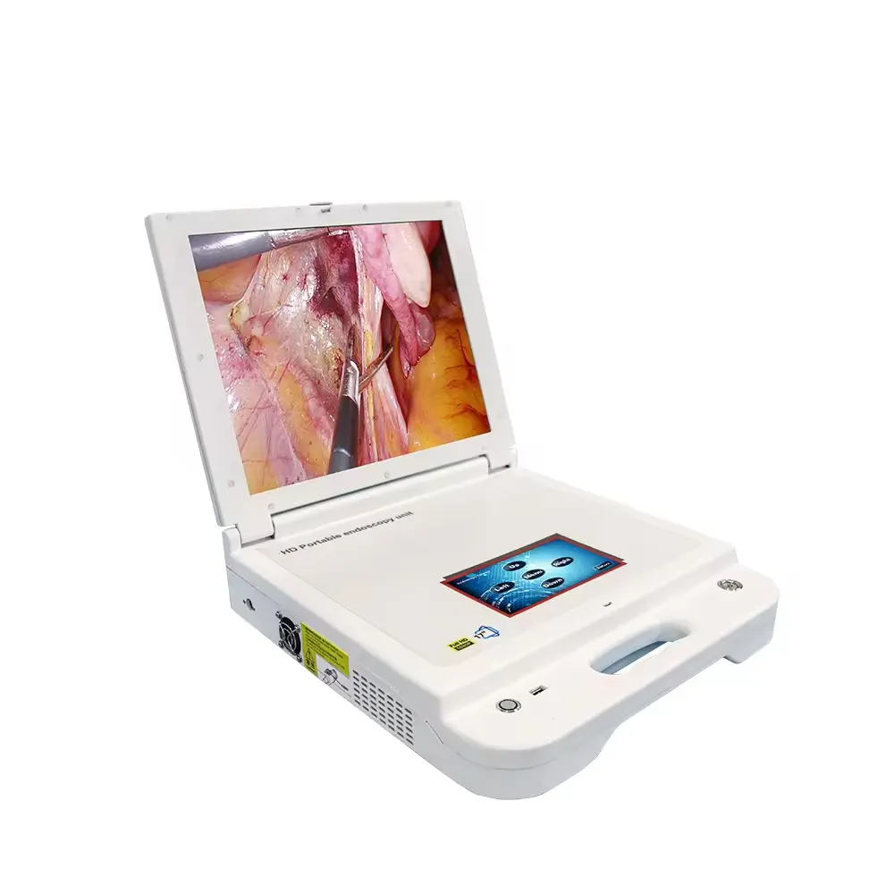 How Gynecological Endoscope Cameras Improve Diagnostic Accuracy 1